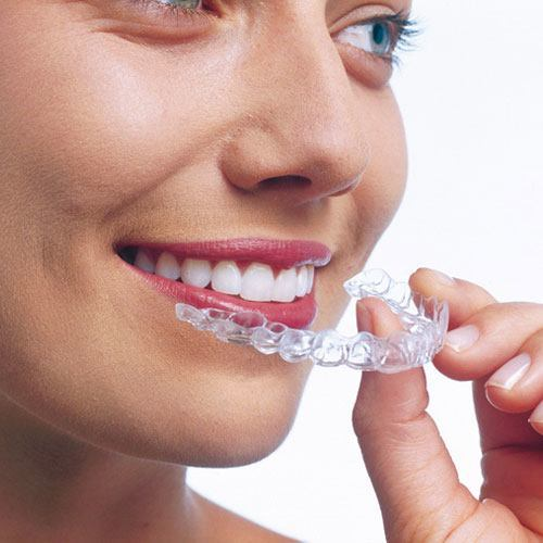 Invisalign In Scarborough ON - Vista Dental Clinic